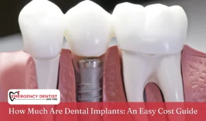 How Much Are Dental Implants An Easy Cost Guide