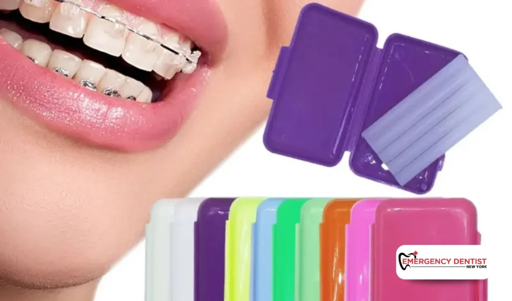 Using Dental Wax for a Cracked Tooth A Temporary Fix