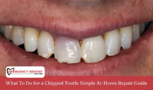 What To Do for a Chipped Tooth Simple At-Home Repair Guide