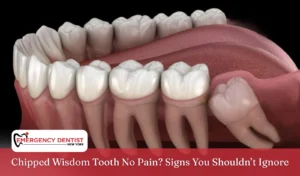 Chipped Wisdom Tooth No Pain Signs You Shouldn’t Ignore