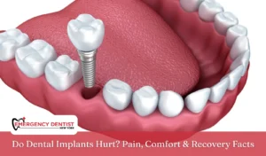 Do Dental Implants Hurt Pain, Comfort & Recovery Facts