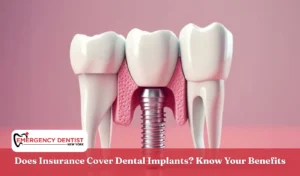 Does Insurance Cover Dental Implants Know Your Benefits