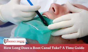How Long Does a Root Canal Take A Time Guide