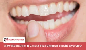 How Much Does It Cost to Fix a Chipped Tooth Overview