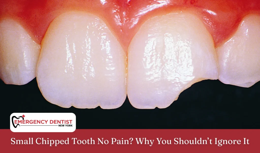 Small Chipped Tooth No Pain Why You Shouldn’t Ignore It