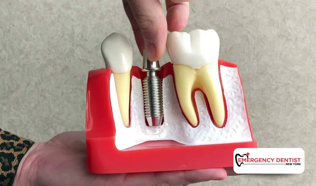 When to Seek Professional Help