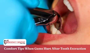Comfort Tips When Gums Hurt After Tooth Extraction