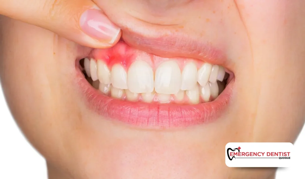 Common Symptoms You Might Notice