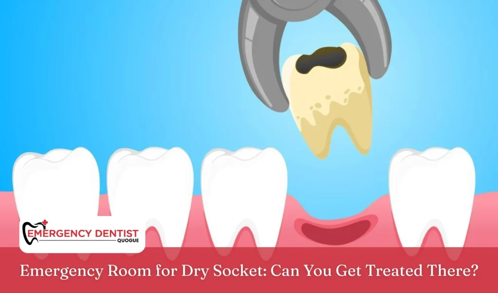 Emergency Room for Dry Socket Can You Get Treated There