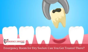 Emergency Room for Dry Socket Can You Get Treated There