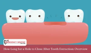 How Long for a Hole to Close After Tooth Extraction Overview