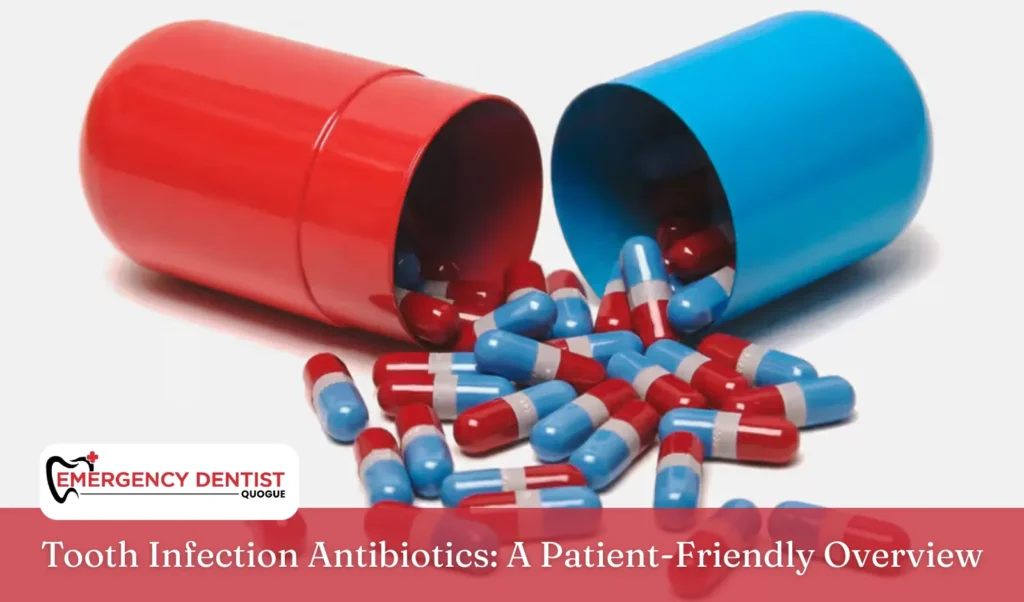 Tooth Infection Antibiotics A Patient-Friendly Overview