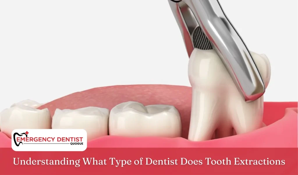 Understanding What Type of Dentist Does Tooth Extractions