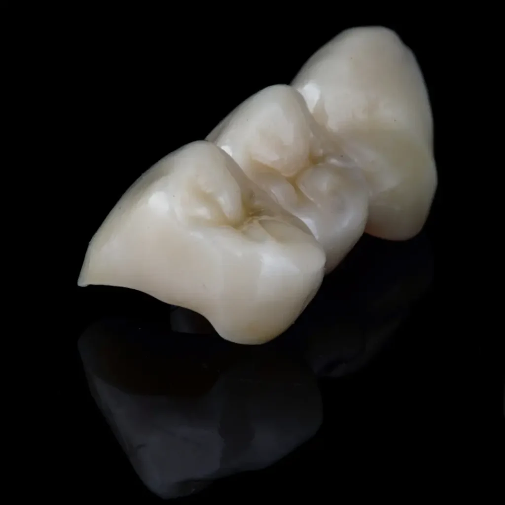 Broken-or-cracked-dental-bridge-Quogue-NY