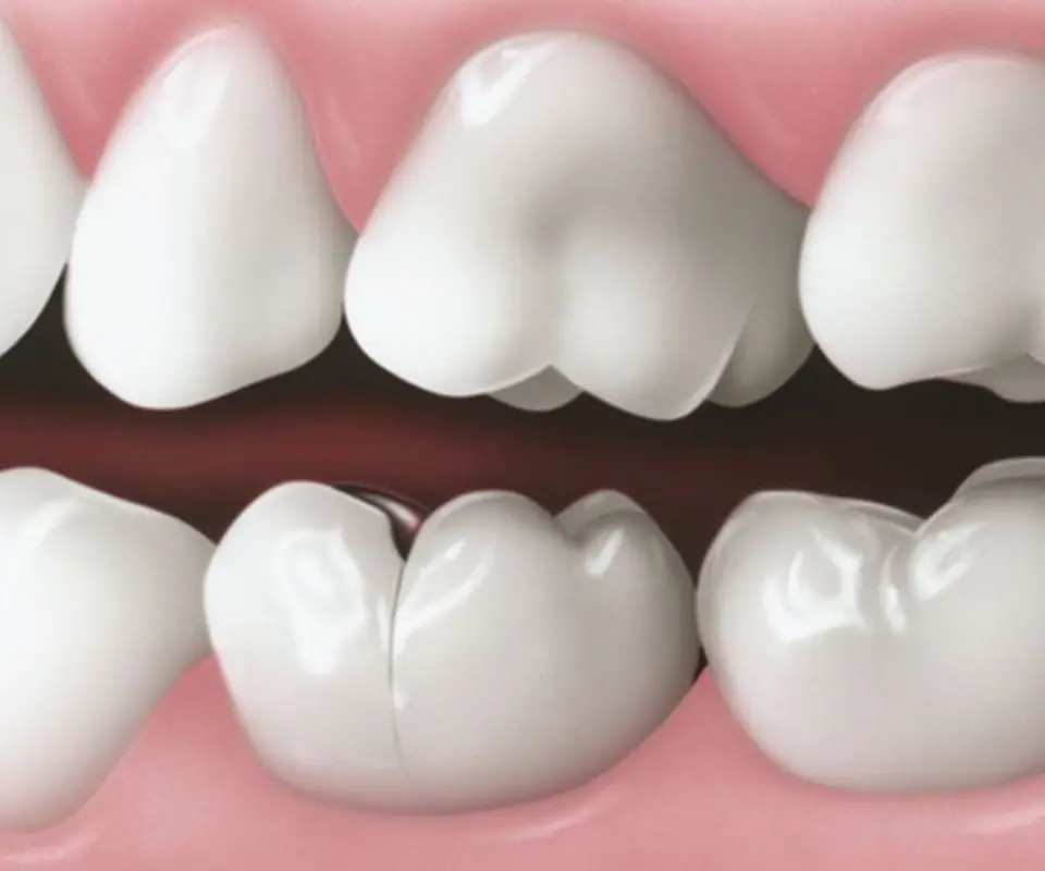 Craze-Lines-Quogue-NY