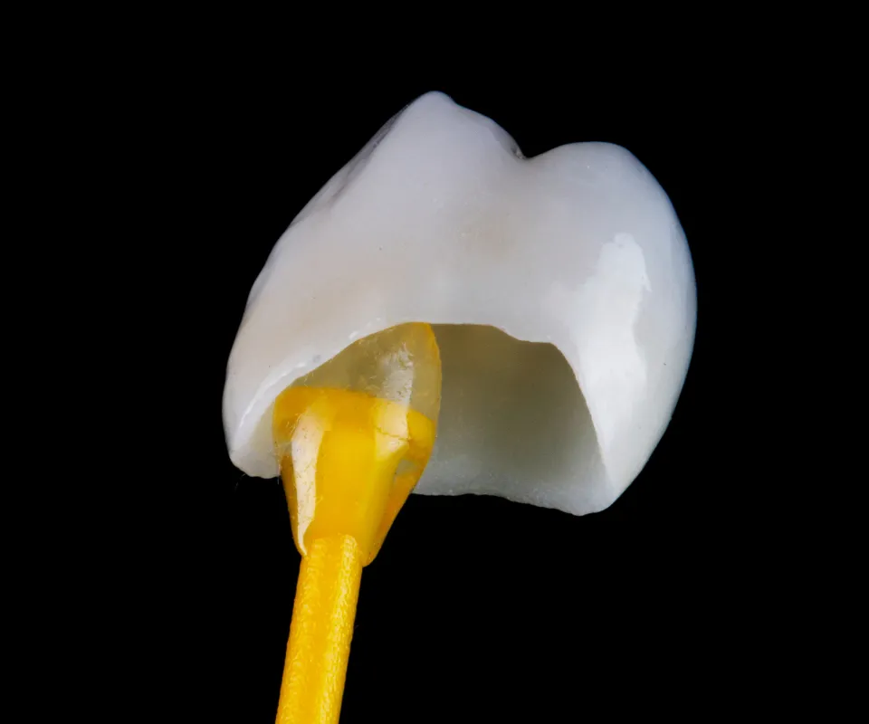 Dental-Crowns-Quogue-NY