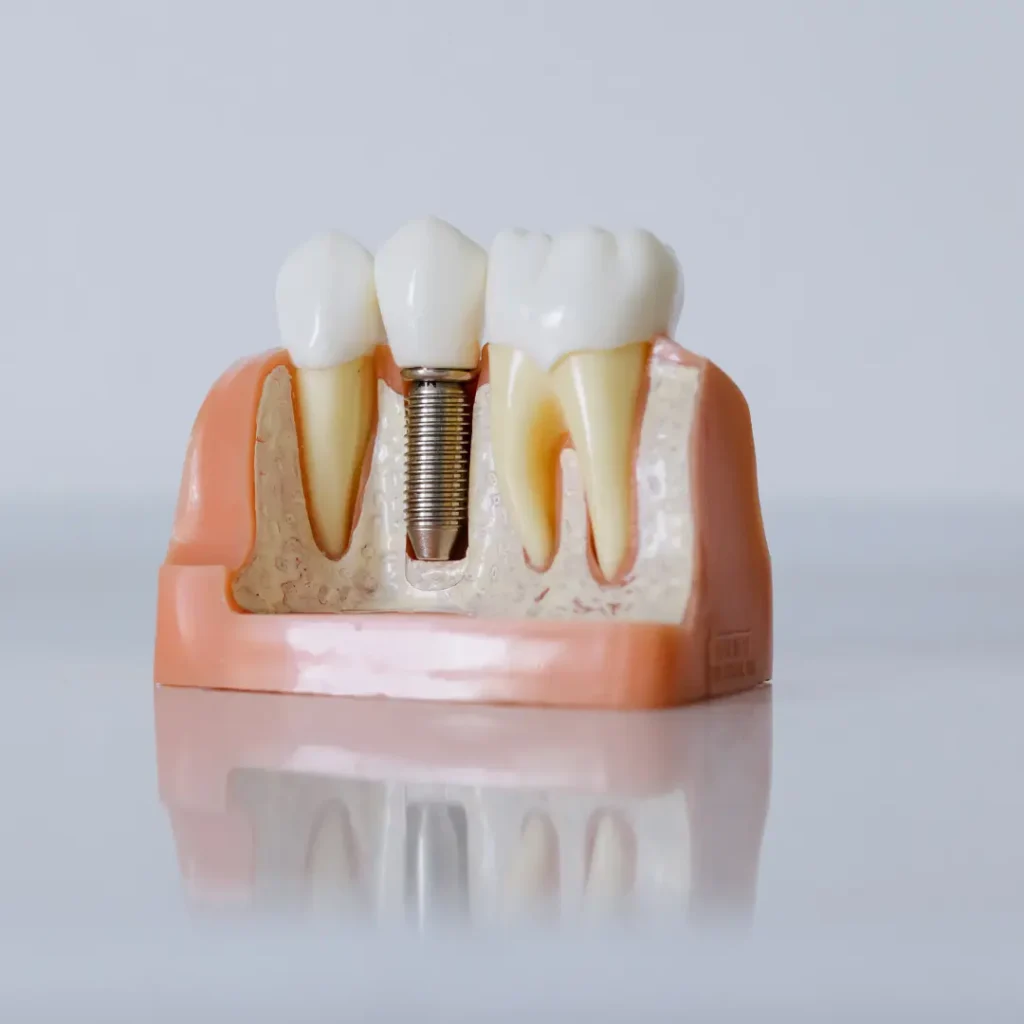 Emergency-Dental-Implant-Quogue-NY