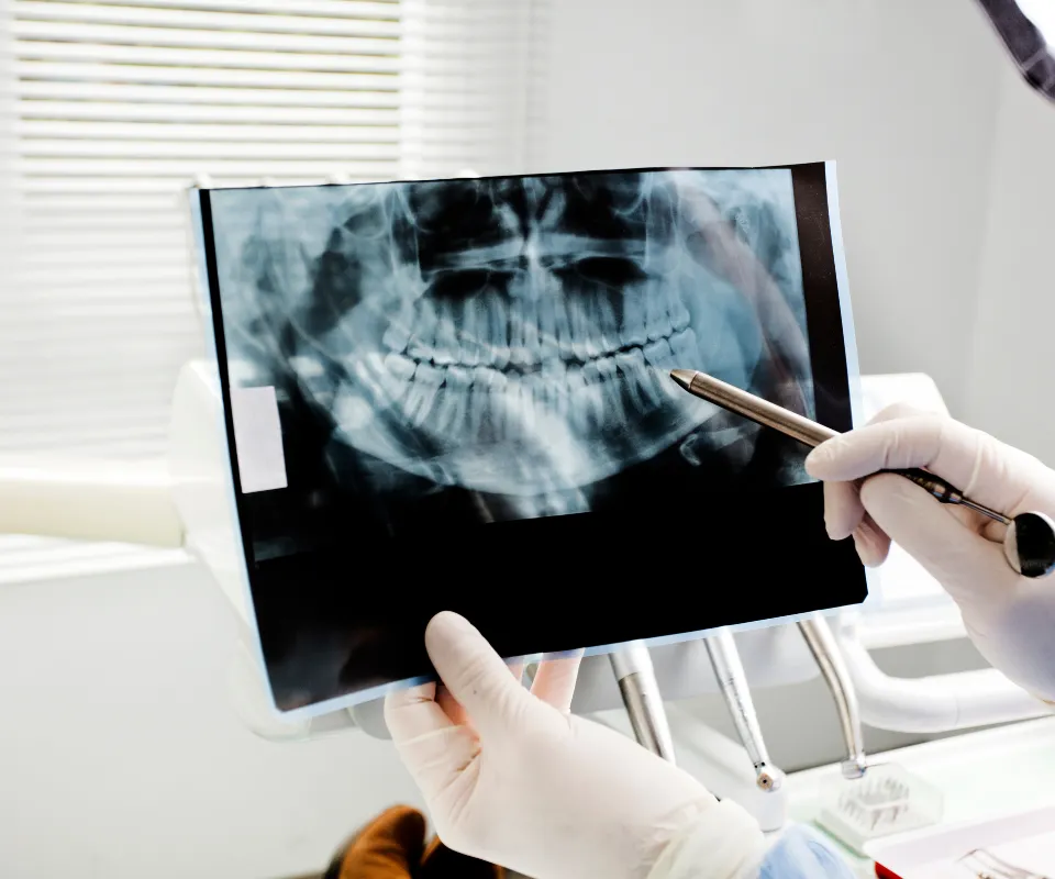 Emergency-dental-X-rays-Quogue-NY
