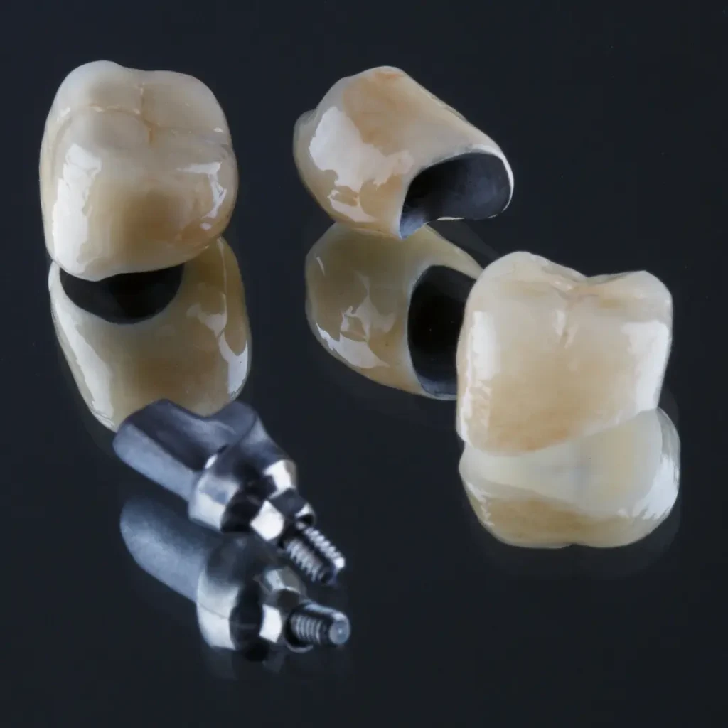 Loose-dental-bridge-or-crown-Quogue-NY