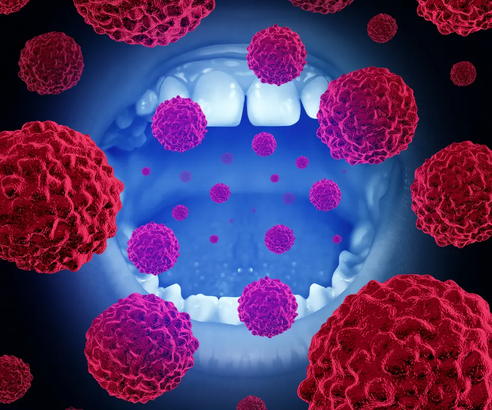 Oral-Cancer-Quogue-NY
