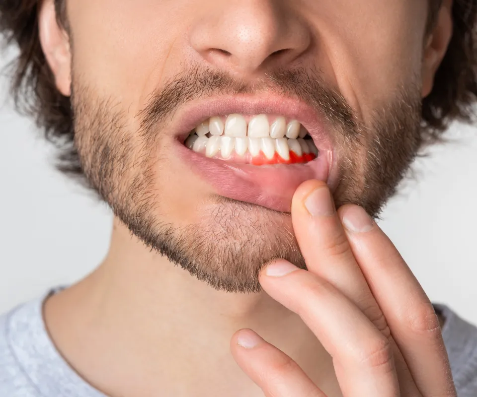 When-to-See-an-Emergency-Dentist-for-a-Tooth-Infection-Quogue-NY