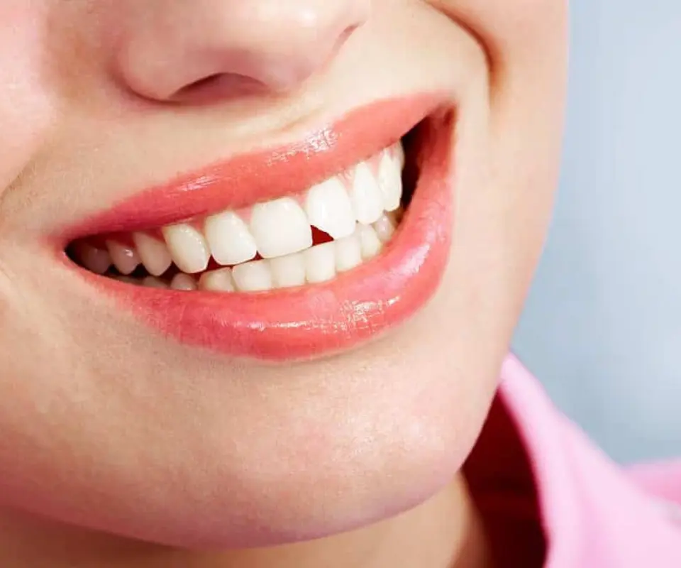 Chipped-Teeth-Quoge-NY